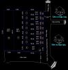 Đất phân lô hẻm xe hơi Đình Phong Phú – Tăng Nhơn Phú B, Thủ Đức – 73m² – 5.9 tỷ TL
